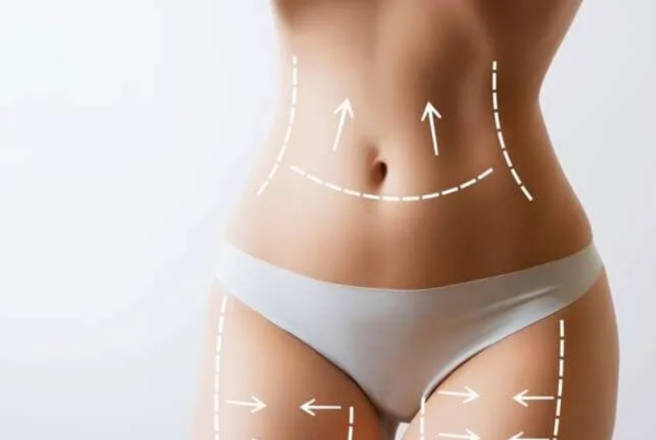 Benefits of Getting a Mommy Makeover in Tijuana Mexico
