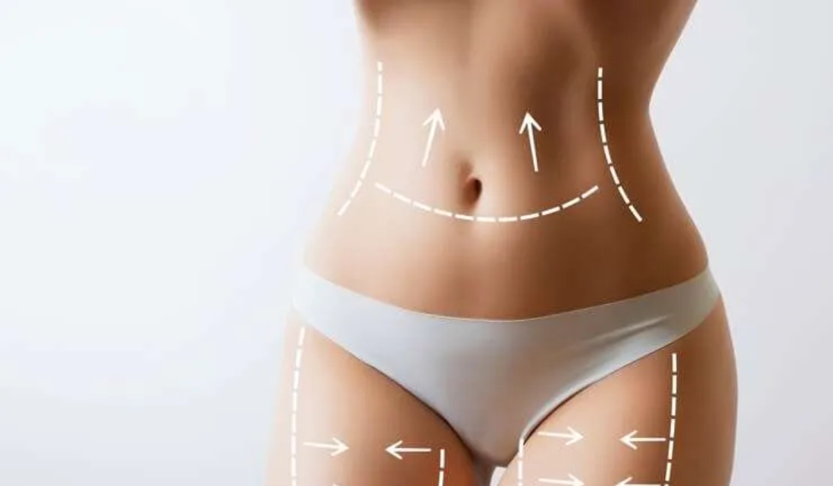 Benefits of Getting a Mommy Makeover in Tijuana Mexico