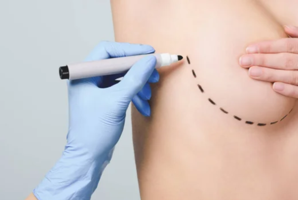 Is it safe to have plastic surgery in Tijuana, Mexico?