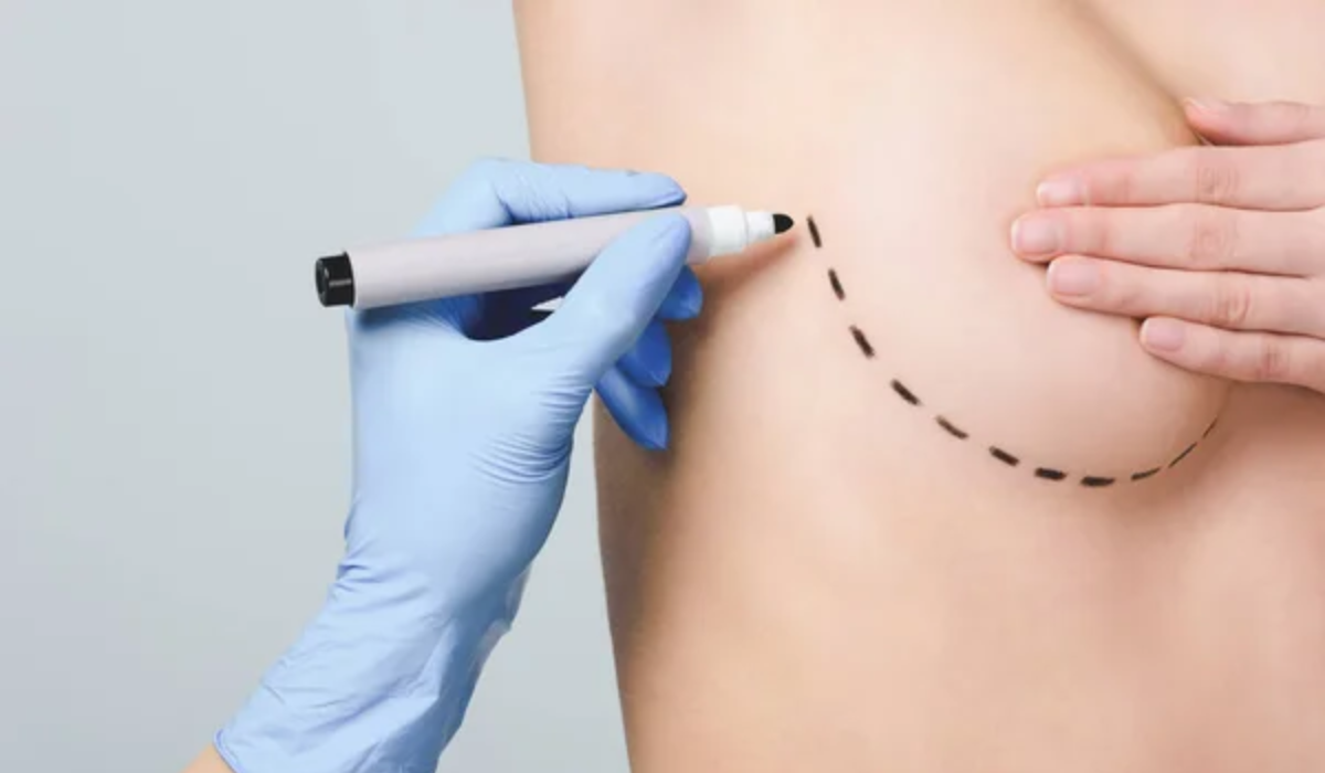Is it safe to have plastic surgery in Tijuana, Mexico?