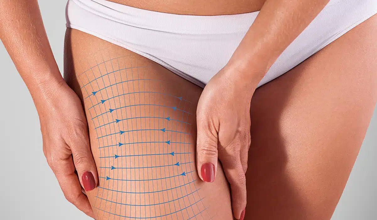 Where to get thigh liposuction in Tijuana? Best clinics in Mexico