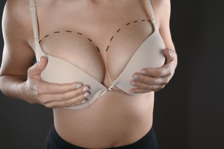 Requisitos para someterse a un aumento de senos en Tijuana