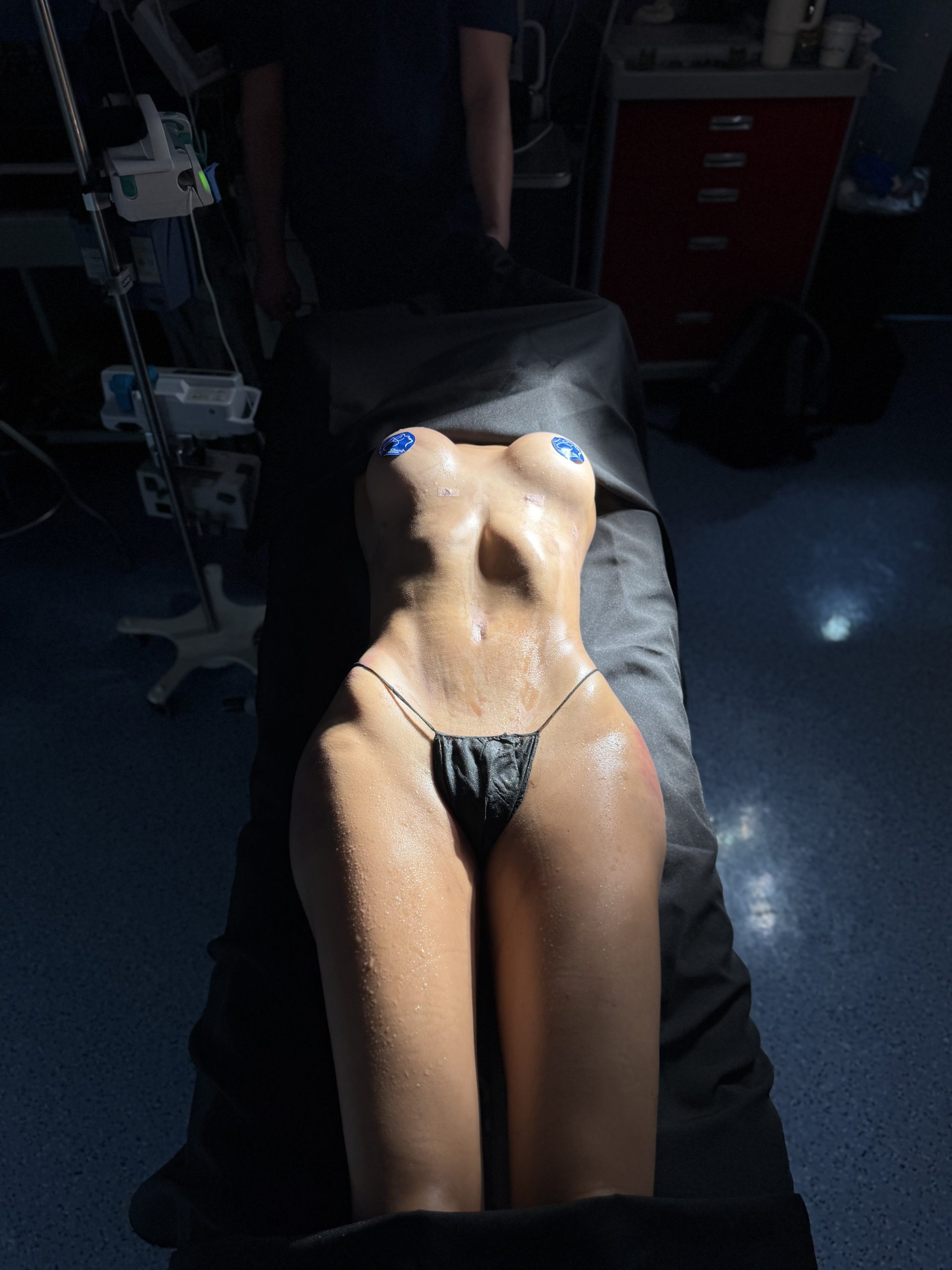 Procedures commonly included in a mommy makeover