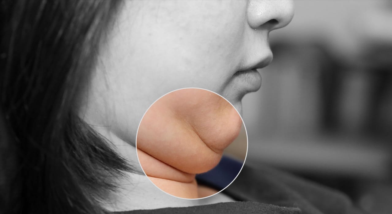 Understanding Facial Surgery